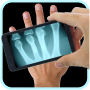 icon Xray Scanner Prank cho AGM X1